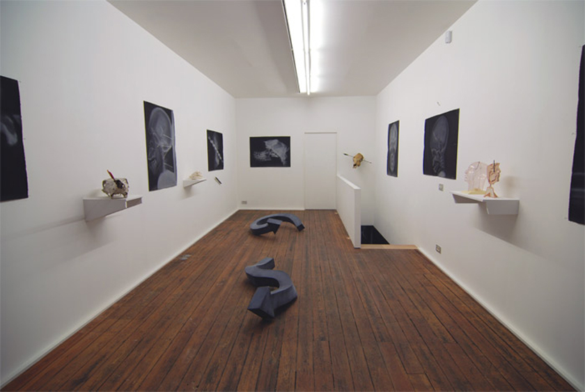 David Colosi, Annals of Roentgenology, 2007